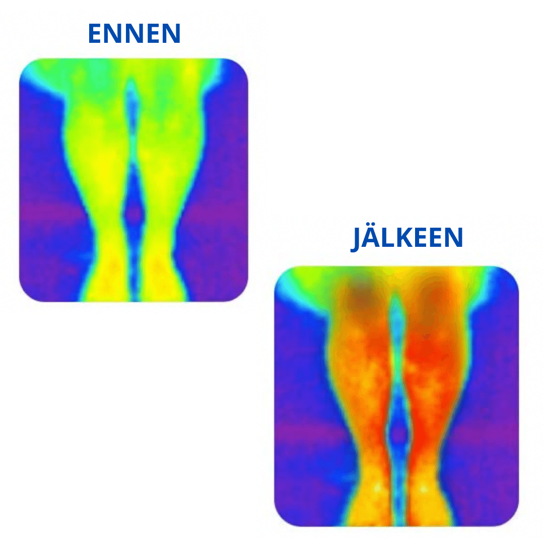 Kompressiolahkeet
